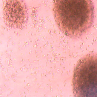 Buon prezzo Prevenire Trattare Tumori Cellule immunitarie Migliorare condizioni di salute tipi di cellule immunitarie in linea