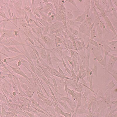 Buon prezzo Migliorare le malattie Le cellule staminali colpiscono otto sistemi principali del corpo umano in linea